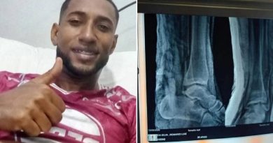 ATERRADORA FRACTURA: La grave lesión de un futbolista que hizo temblar a sus compañeros (VIDEO)