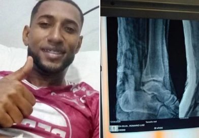 ATERRADORA FRACTURA: La grave lesión de un futbolista que hizo temblar a sus compañeros (VIDEO)