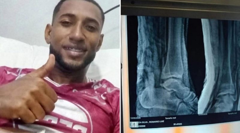 ATERRADORA FRACTURA: La grave lesión de un futbolista que hizo temblar a sus compañeros (VIDEO)