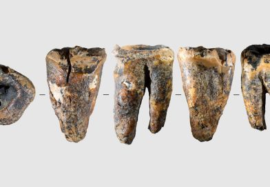 Neandertales contra el caries: encuentran la evidencia más antigua conocida de un tratamiento dental invasivo