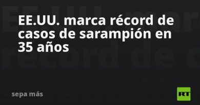 EE.UU. marca récord de casos de sarampión en 35 años