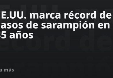 EE.UU. marca récord de casos de sarampión en 35 años
