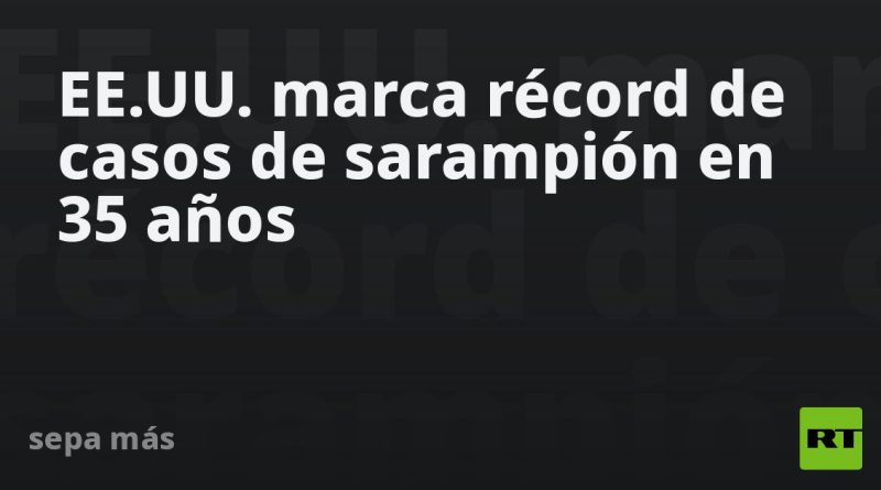 EE.UU. marca récord de casos de sarampión en 35 años